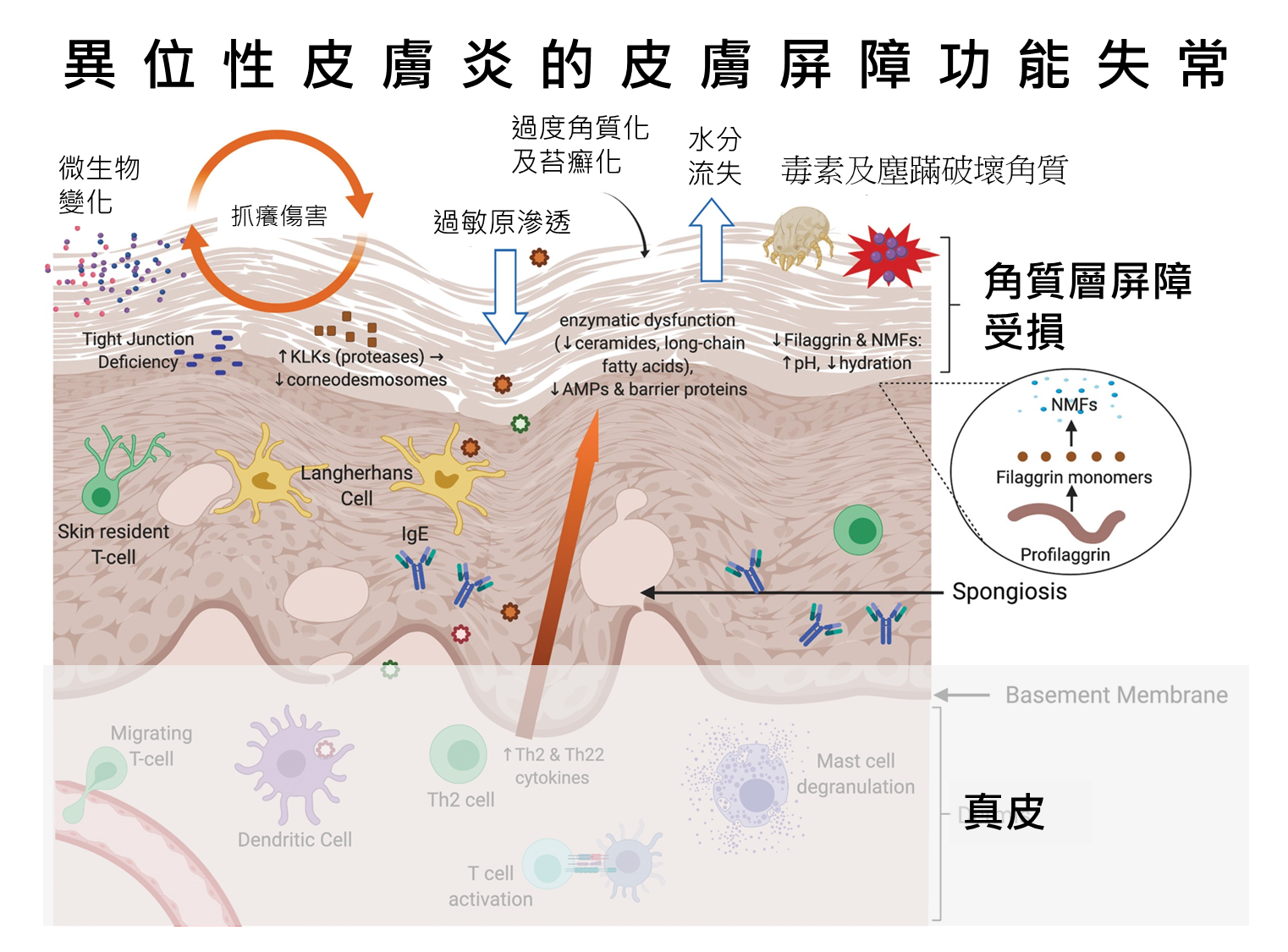 異位性皮膚炎的各類刺激機轉,濕疹症狀的原因 異位性皮膚屏障失去功能後,會被許多外來刺激物引起發炎