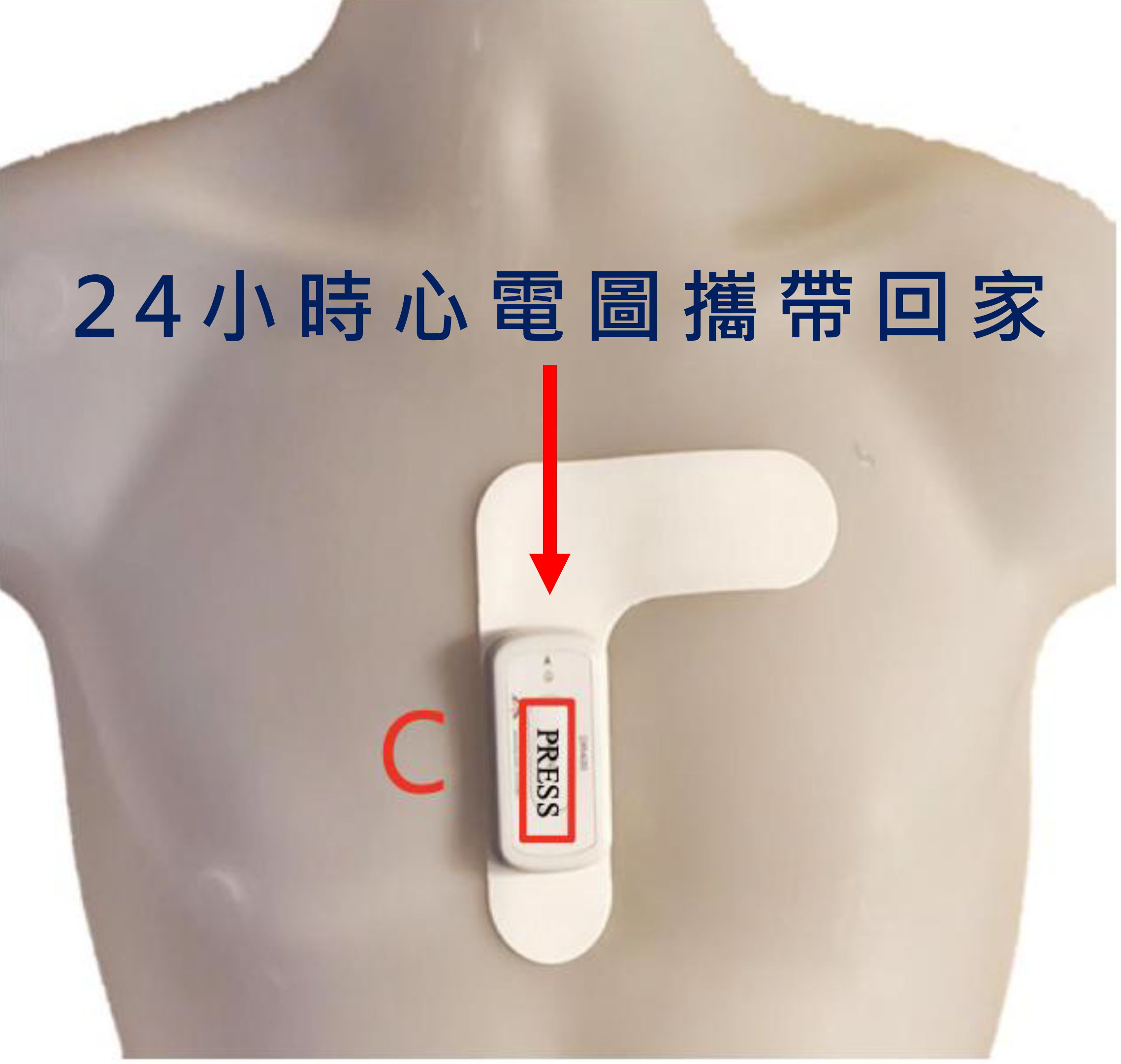 24小時心電圖診斷心悸、心律不整